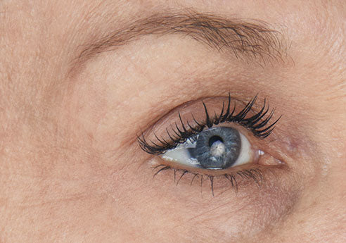 Darlene_Eye_After-_opt