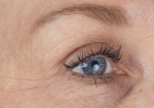 Darlene_Eye_before-_opt